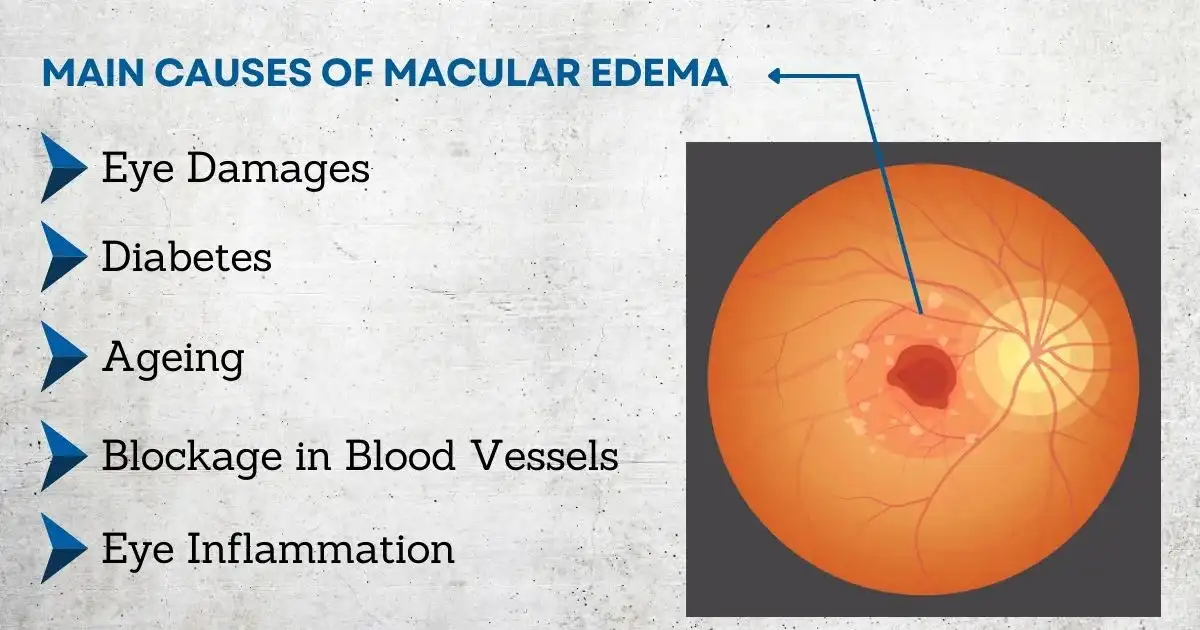 Benefits of Diabetic Eye Care