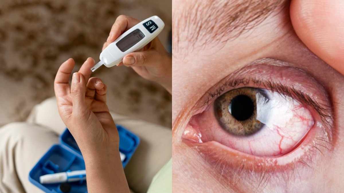 Daily Care for Diabetic Eye Health