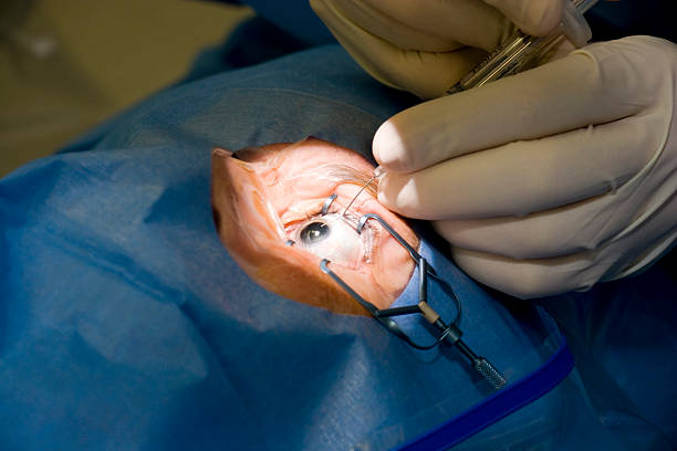 Retina Surgery by Dr. Vishal Maniar